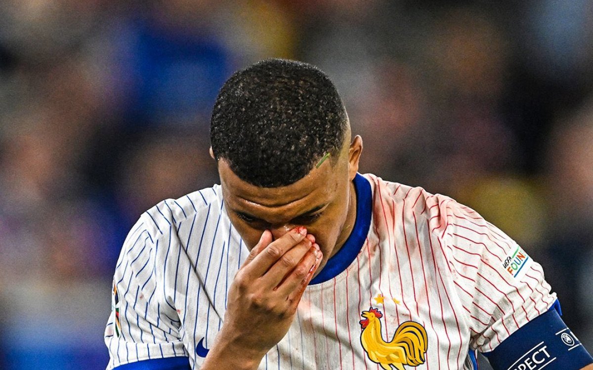 Euro 2024: France s Mbappe May Miss Remaining Group Stage Games Following Nose Injury: Report